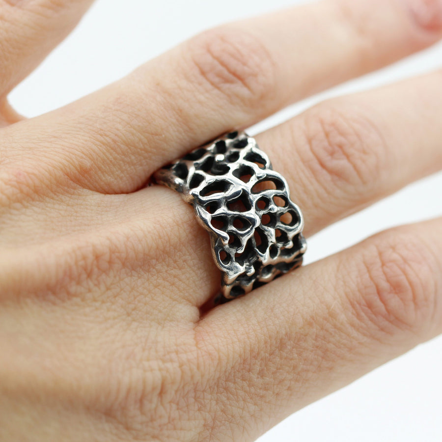 L'anello al dito: la fascia copre quasi tutta la falange